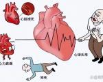 偶发性室性早搏患者在日常生活中应该注意哪些饮食问题？