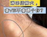 淋巴结肿大，不痛才危险