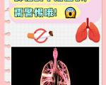 肺癌早期症状和普通呼吸道疾病症状有哪些区别？