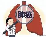 肺癌的高危人群有哪些？