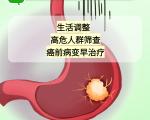 守护胃健康，远离肿瘤风险