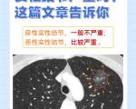 如何判断肺结节是良性还是恶性？