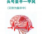 大脑“短暂停机”的症状一般会在什么情况下发生？