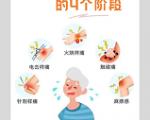 调节情绪对于预防带状疱疹有多大作用？