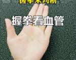 血管内皮抵抗力下降的原因有哪些？
