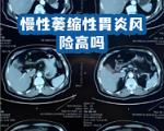 幽门螺杆菌感染会增加慢性萎缩性胃炎发展成胃癌的几率吗？