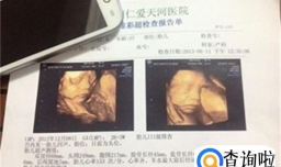 打四维宝宝的图片和生下宝宝的相貌有区别吗 快来看看