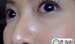 怎么才能控油?
