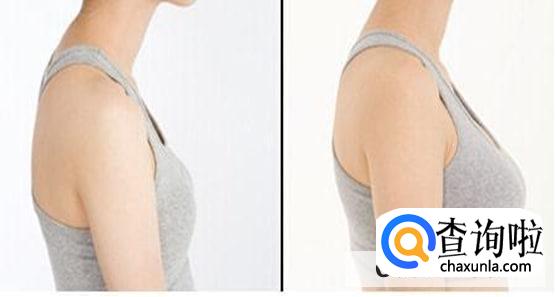 假体丰胸三个月了能做瑜伽吗