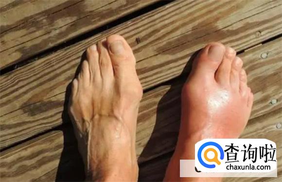 什么人不能吃海鲜