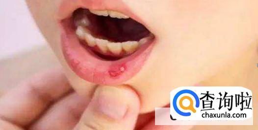 橘子吃多了会上火吗br