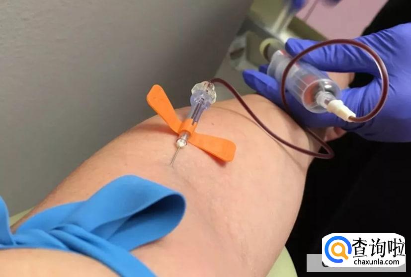 手上经常出现红点点是什么情况