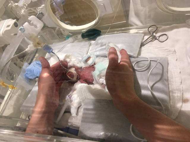 世界上最小的婴儿
