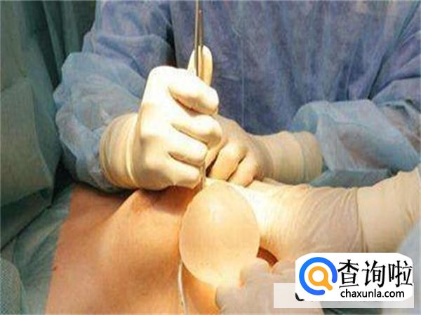 假体隆胸能取出来吗