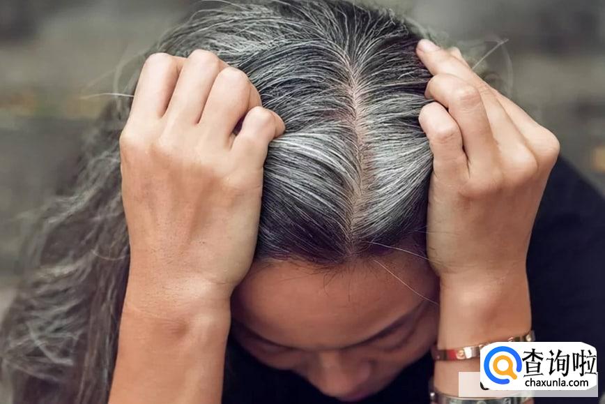 头发花白应该吃什么食物