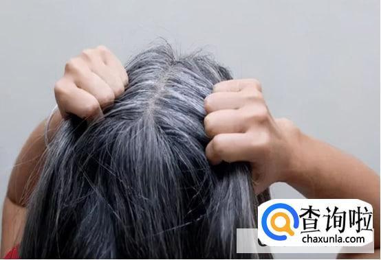 产生白发的原因