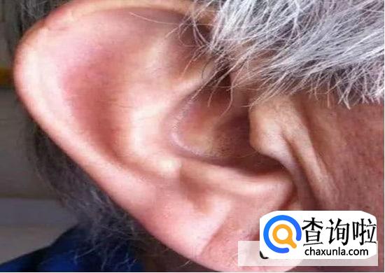 怎样消除耳垂皱纹