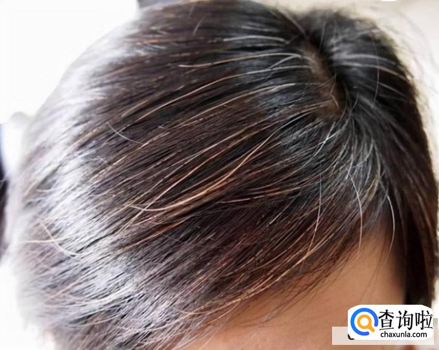 头发花白应该吃什么食物