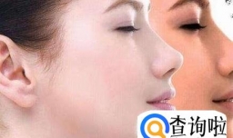 晒黑后怎么快速美白方法