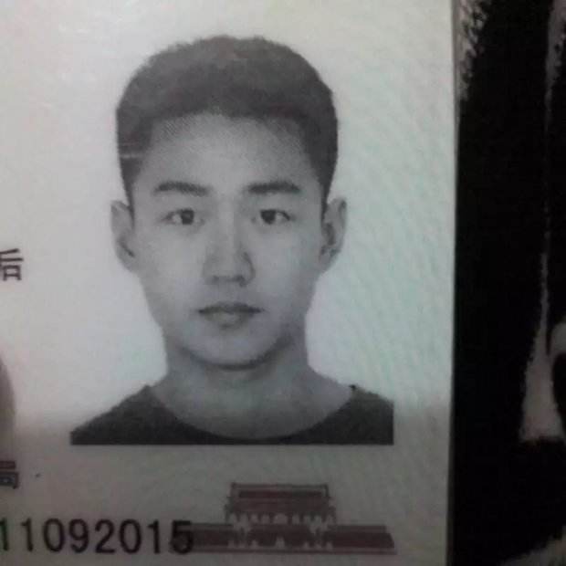 脸部一边大一边小怎么办