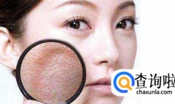 如何治疗毛孔粗大?