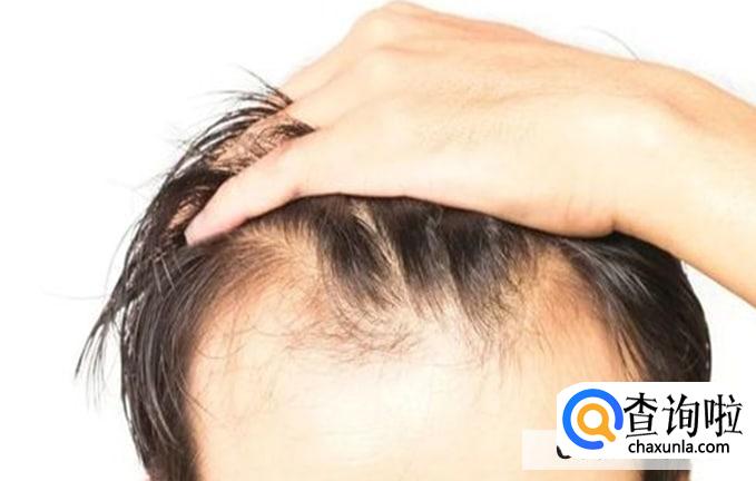 14岁发际线怎么养回来