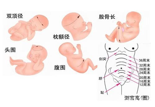双顶径是什么意思