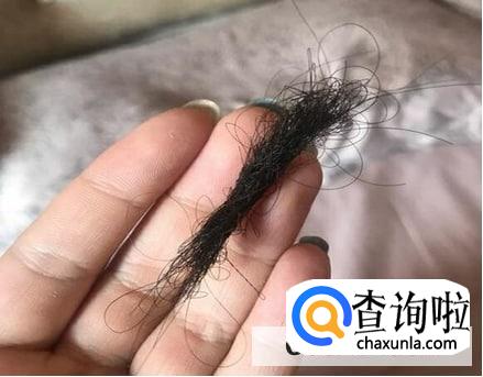 生孩子之后头发掉得很严重应该怎么办