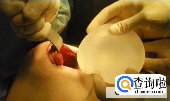 假体丰胸三个月了能做瑜伽吗