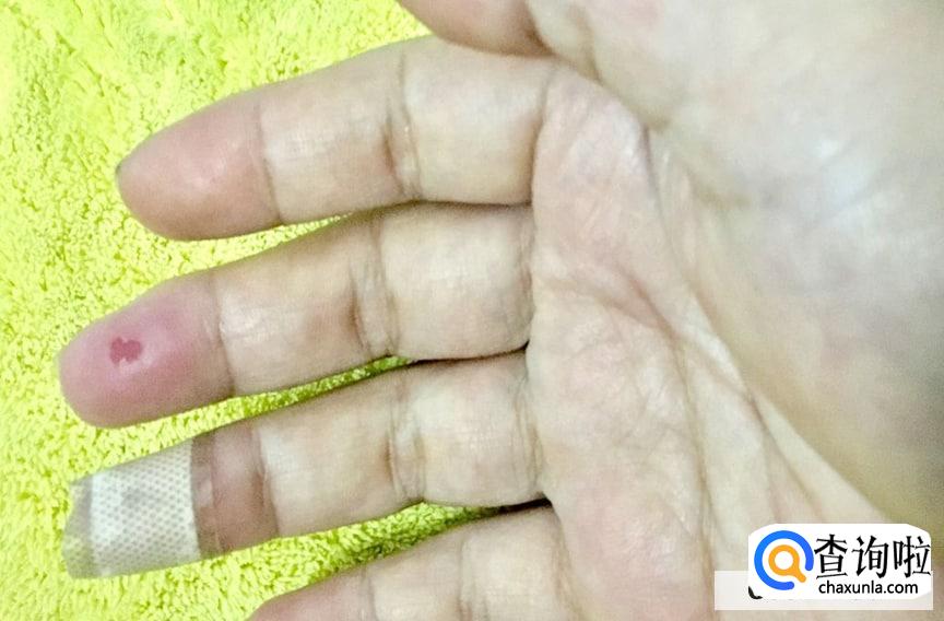 怎样让自己的手指变长