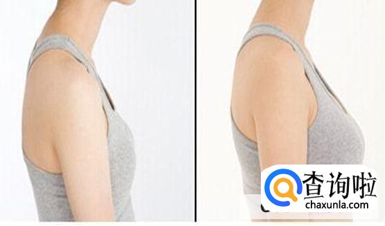 自体脂肪丰胸有效果么