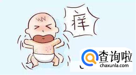 处理新生儿湿疹小妙招