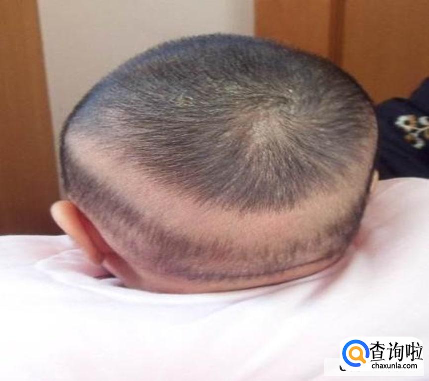 1岁宝宝缺钙有什么症状呢