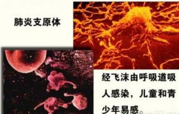 肺炎支原体抗体阳性是什么意思