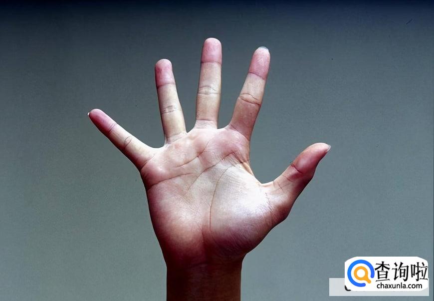 手蜕皮是怎么回事