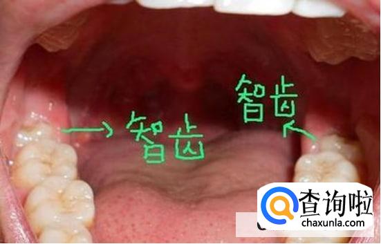 天天都能做的口腔保健方法细节是关键