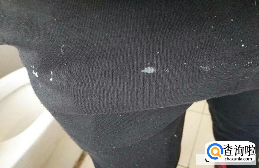黑裤子上的白胶怎么样才能洗掉