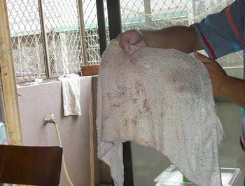 毛巾上的霉点怎么洗