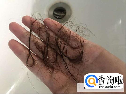 怎么算是脱发