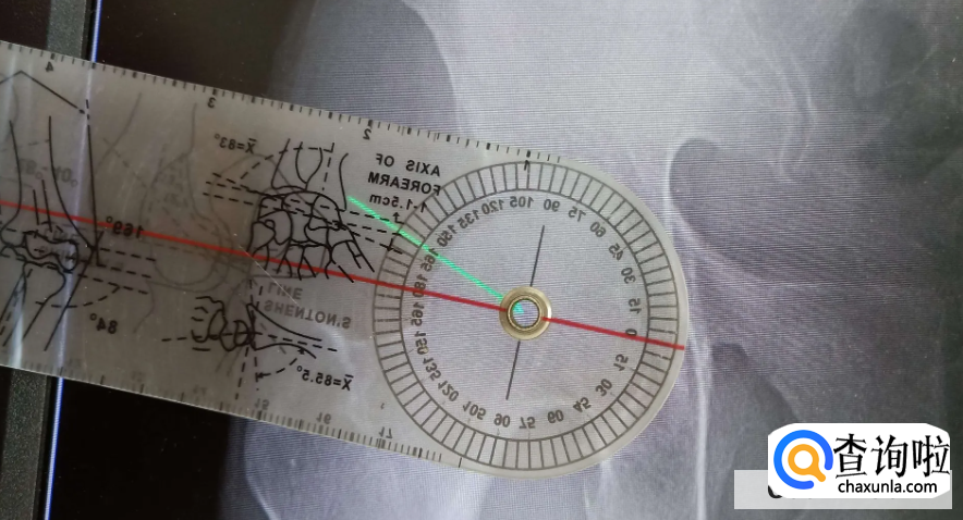 拉伸真的能长高吗