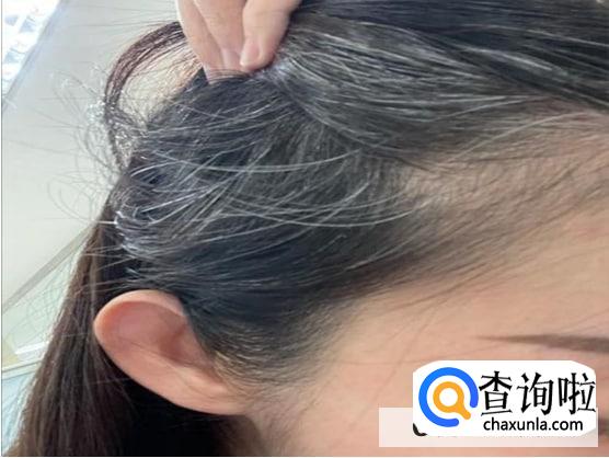 女孩为什么会长白头发