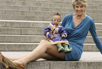 世界上最小的人